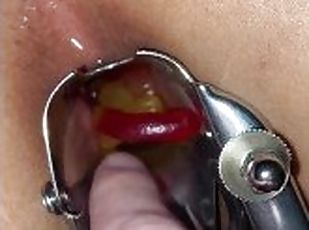 Amateur WMAF Anal Speculum Stuffed with Gummy Worms and Assfucked